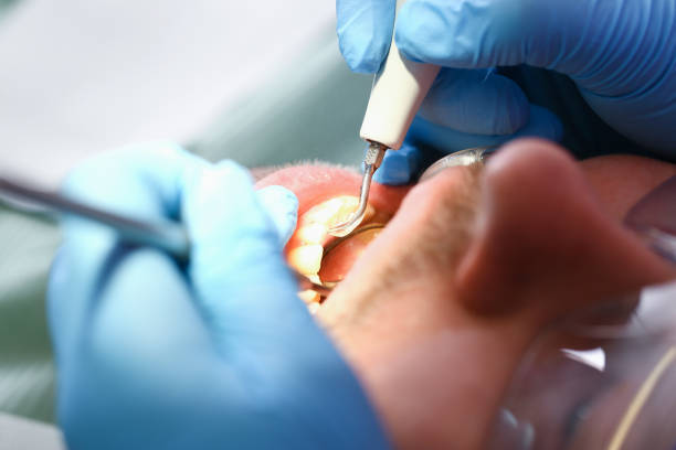 Best Emergency Treatment for Dental Infections or Abscesses in Kenyon, MN