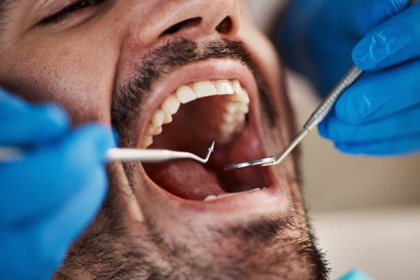 Best Emergency Treatment for Dental Infections or Abscesses in Kenyon, MN